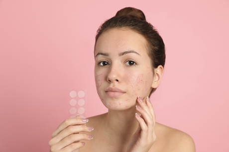 Best Korean Pimple Patches: Your Secret Weapon for Clear Skin