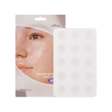 Isntree Onion Newpair Spot Patch Skin Fit 15patch